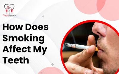 How Does Smoking Affect My Teeth?