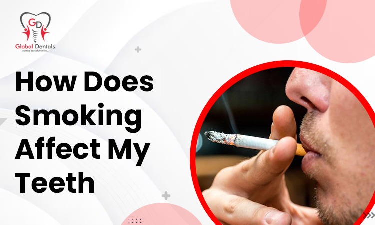 How Does Smoking Affect My Teeth?