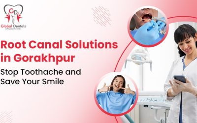 ROOT CANAL SOLUTIONS IN GORAKHPUR : STOP TOOTHACHE AND SAVE SMILE