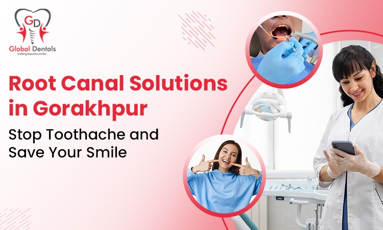 ROOT CANAL SOLUTIONS IN GORAKHPUR STOP TOOTHACHE AND SAVE SMILE