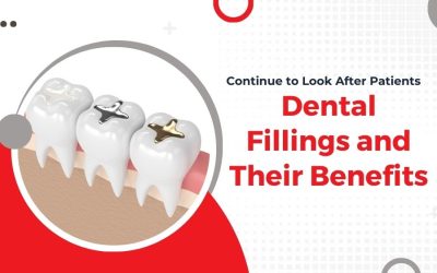 Understanding the Different Types of Dental Fillings and Their Benefits