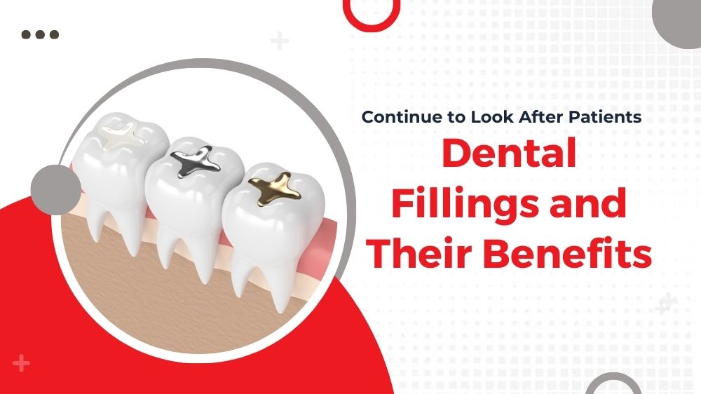 Understanding the Different Types of Dental Fillings and Their Benefits