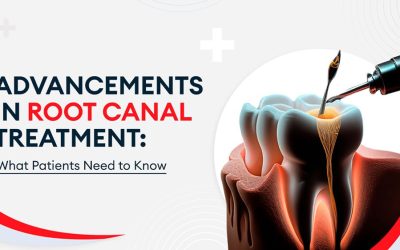 Advancements in Root Canal Treatment: What Patients Need to Know