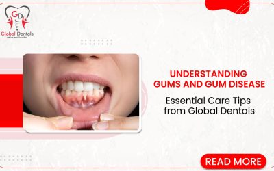 Understanding Gums and Gum Disease: Essential Care Tips from Global Dentals            