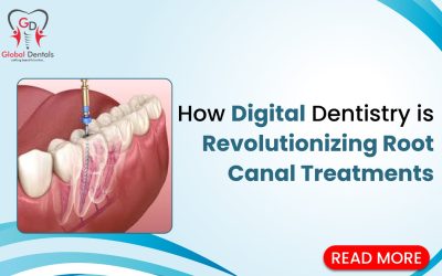 How Digital Dentistry is Revolutionizing Root Canal Treatment?