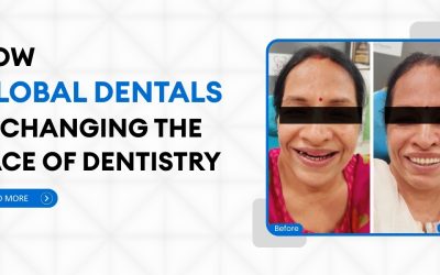 How Global Dentals is changing the face of dentistry
