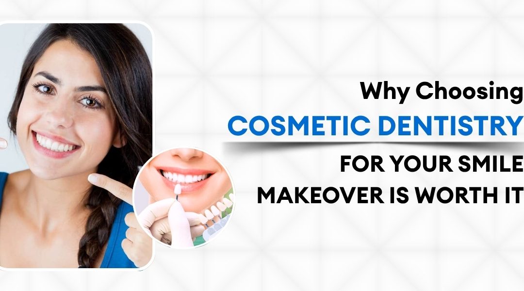 Why Choosing Cosmetic Dentistry for Your Smile Makeover Is Worth It