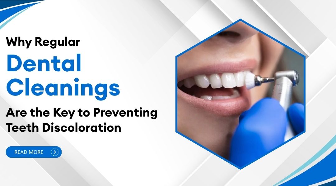 Why Regular Dental Cleanings Are the Key to Preventing Teeth Discoloration