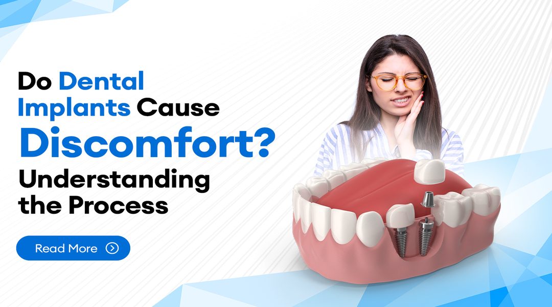 Do Dental Implants Cause Discomfort? Understanding the Process