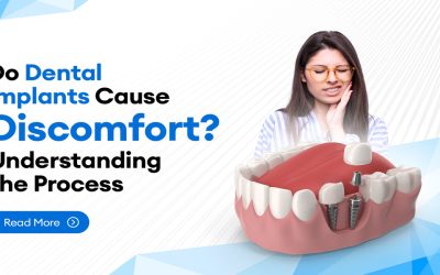 Do Dental Implants Cause Discomfort? Understanding the Process