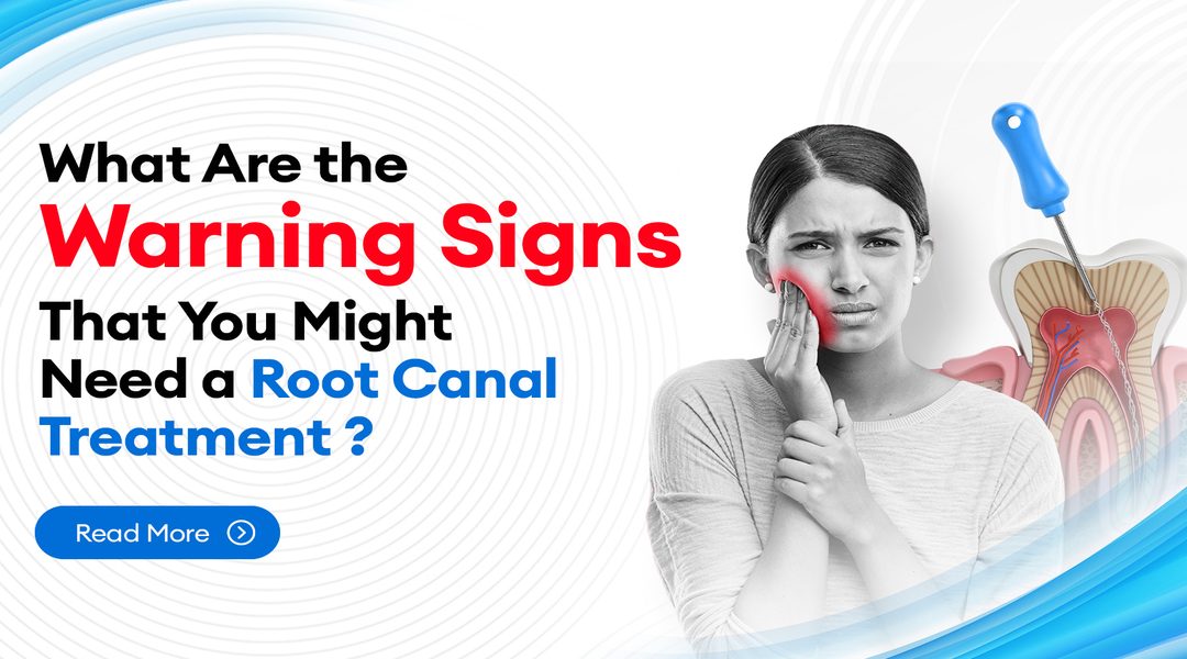 What Are the Warning Signs That You Might Need a Root Canal Treatment?
