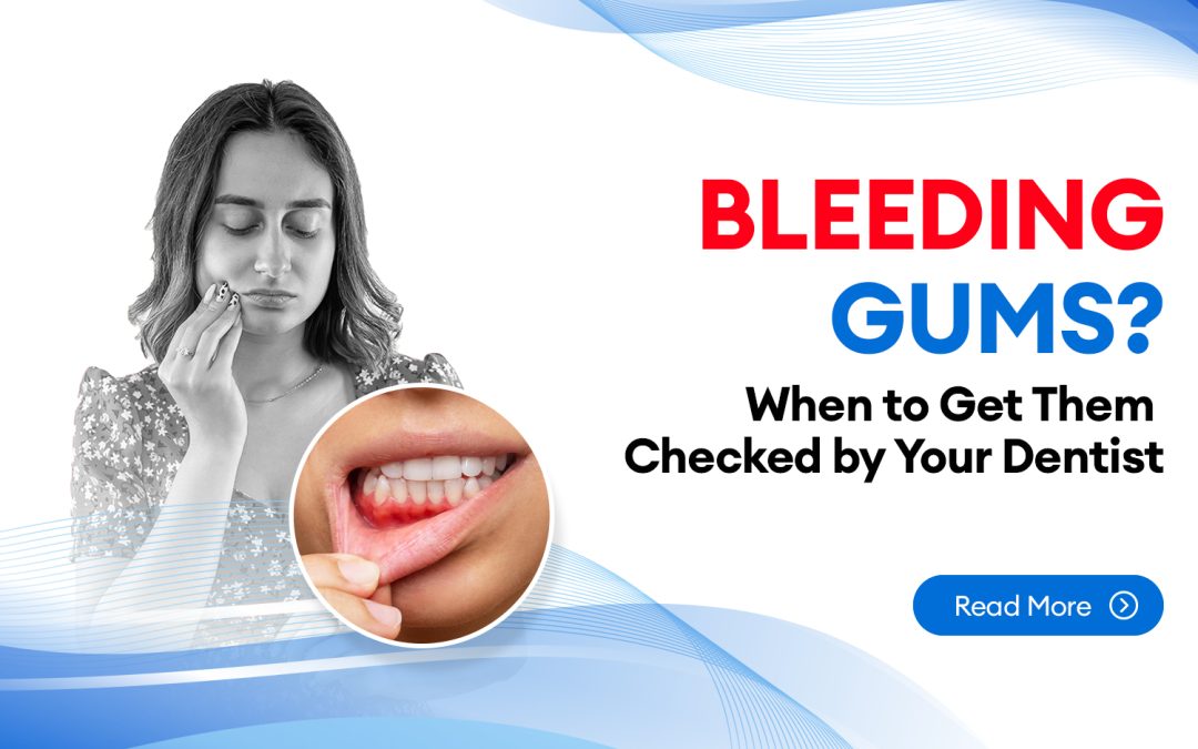 Bleeding Gums When to Get Them Checked by Your Dentist