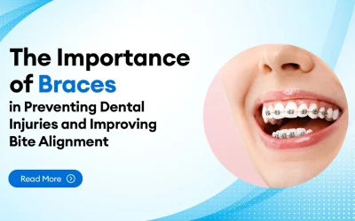 The Importance of Braces in Preventing Dental Injuries and Improving Bite Alignment