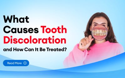 What Causes Tooth Discoloration and How Can It Be Treated?