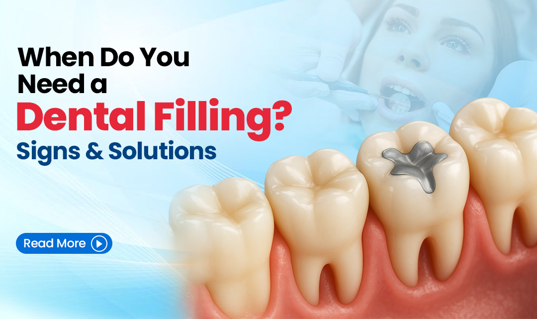 When Do You Need a Dental Filling Signs and Solutions