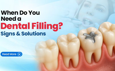 When Do You Need a Dental Filling? Signs and Solutions