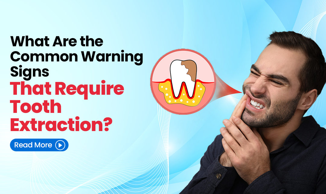 What Are the Common Warning Signs That Require Tooth Extraction?