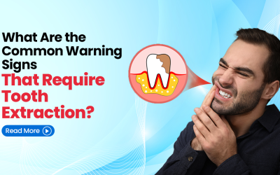 What Are the Common Warning Signs That Require Tooth Extraction?