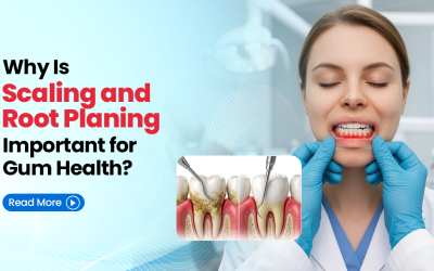 Why Is Scaling and Root Planing Important for Gum Health?