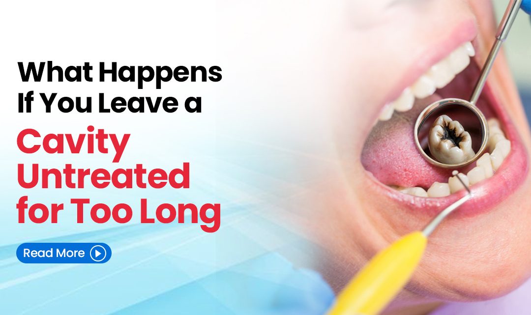 What Happens If You Leave a Cavity Untreated for Too Long?