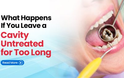 What Happens If You Leave a Cavity Untreated for Too Long?